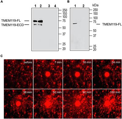 A New Understanding of TMEM119 as a Marker of Microglia